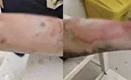 开云体育下载-罗马仕充电宝自燃致三度烧伤事故：非召回批次产品